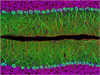 cerebellum 4